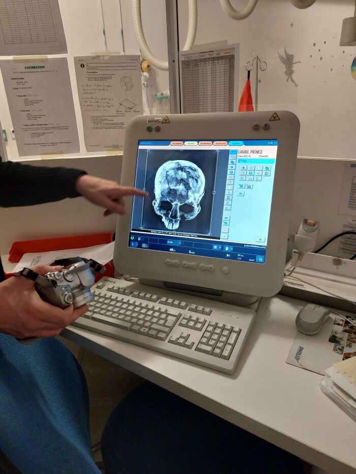 Conférence : Dans l’intimité du prince de Lavau (Aube) : étude d’un homme de pouvoir et traitement post-mortem d’un défunt hors-normes_Troyes ©Inrap